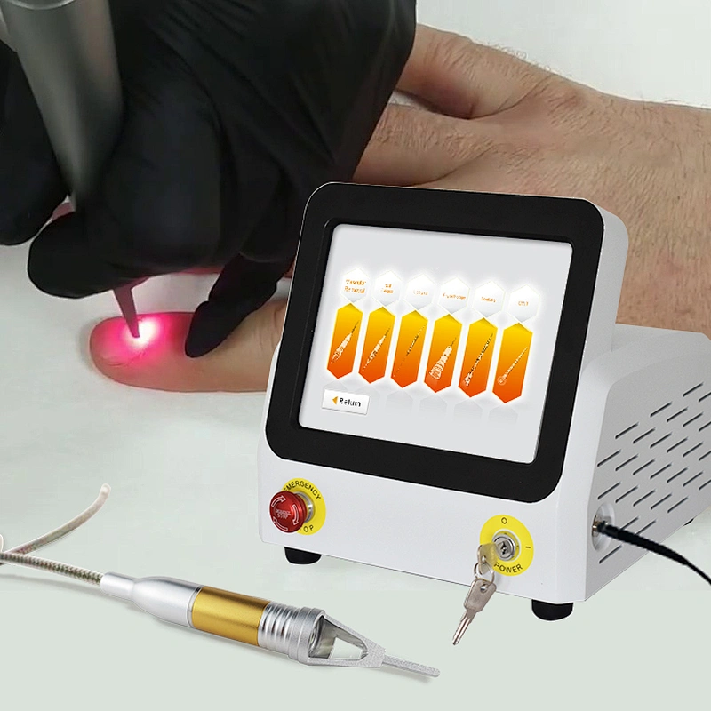 Professional Podiatry Podiatrist Doctor Use Nail Fungus Onychomycosis Laser 980nm 1064nm Fungal Nail Laser Machine