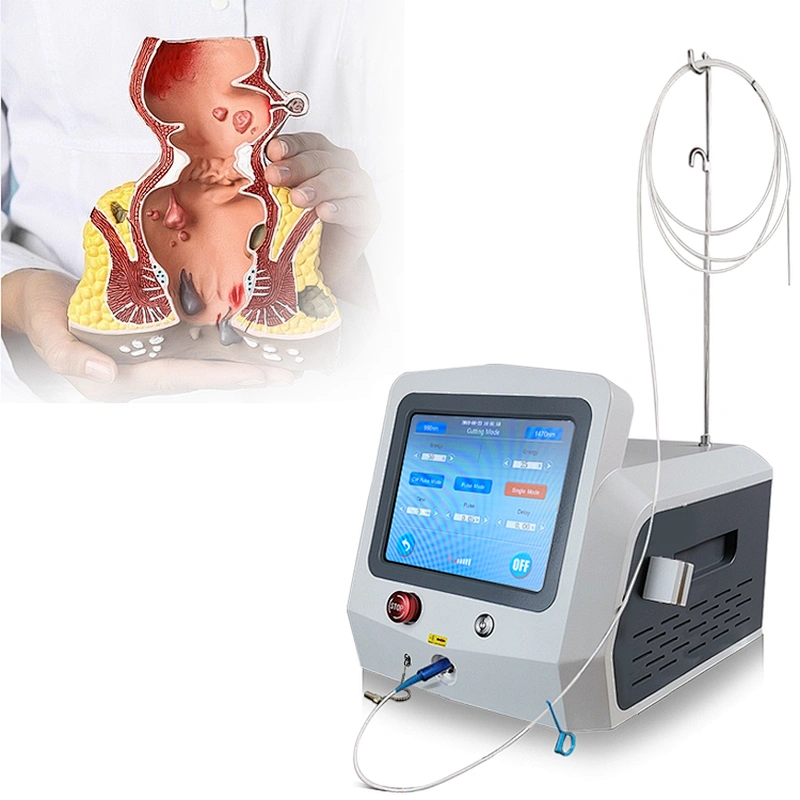 Factory Price Hot Sale Proctology Laser Surgery Machine Diode Laser 980nm1470nm Treatment Hemorrhoids(piles)