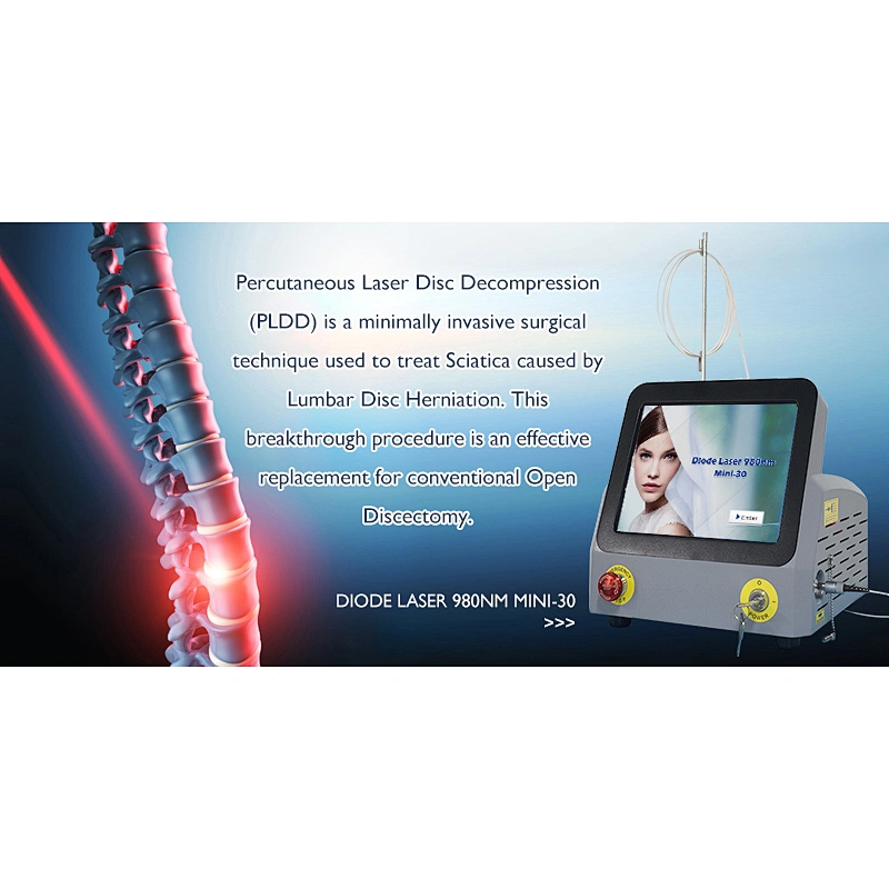 Class IV Medical Diode Laser 980nm PLDD Percutaneous Laser Treatment Machine
