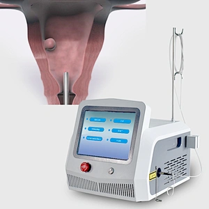 Diode Laser 1470nm/980nm Minimally Invasive Surgery Gynecological Gynecology  Laser Gynaecology Machine