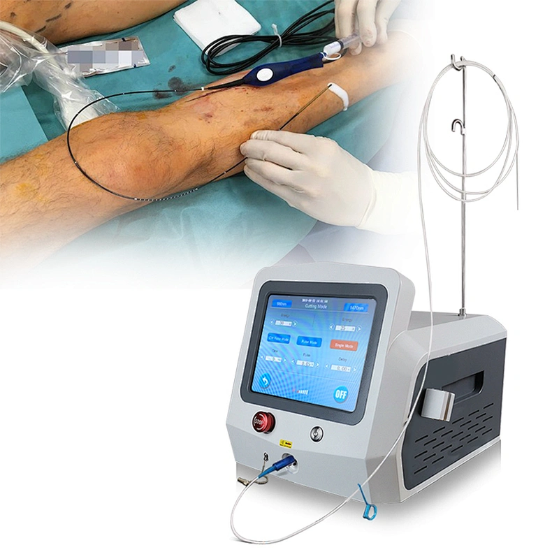 Varicose Veins Laser Treatment Machine Laser De Diodo