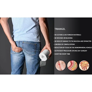 1470 Diode Laser Spider Proctology Hemorrhoids 980 Hemorrhoid Surgic Laser Instrument