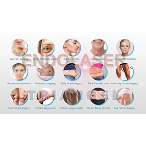 2023 Hot Sale 980nm  Liposuction Diode Laser Surgical Lipolysis  Laser Machine