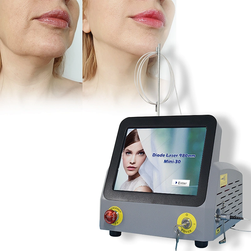 Triangel 980nm Laser Skin Tightening Eyebags  Lipolysis  Machine