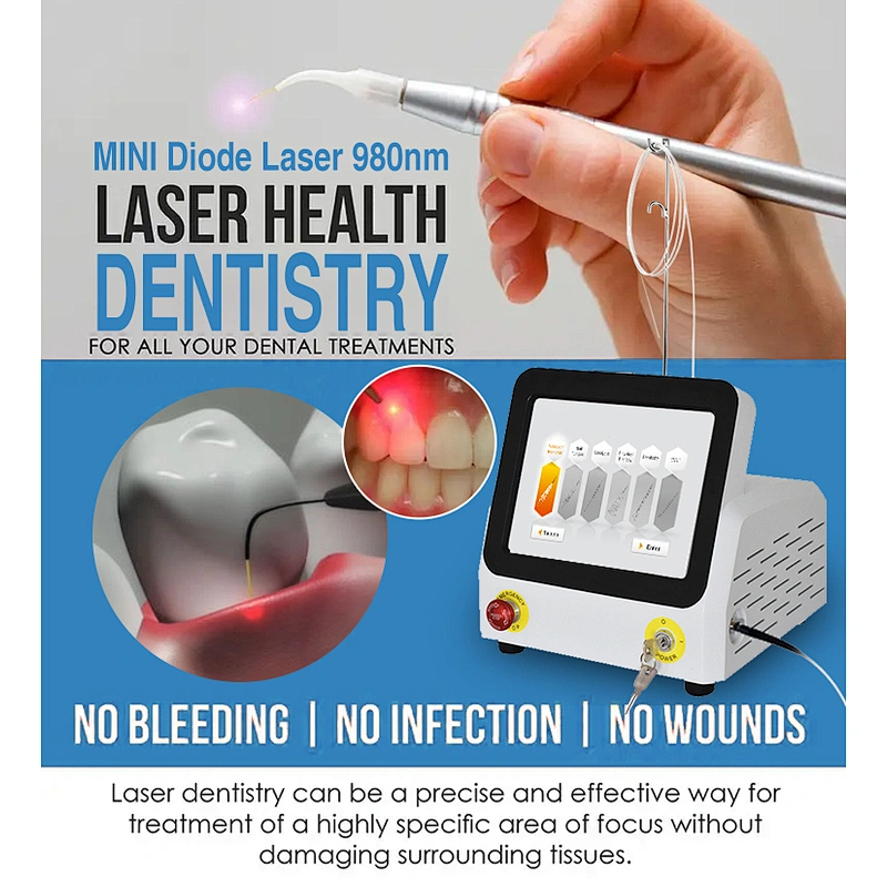 980nm Dental Laser Therapeutic Instrument