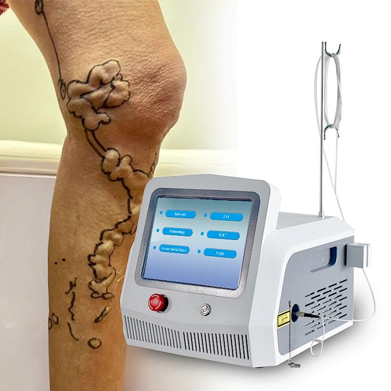 Varicose Veins Laser Treatment Machine Laser De Diodo