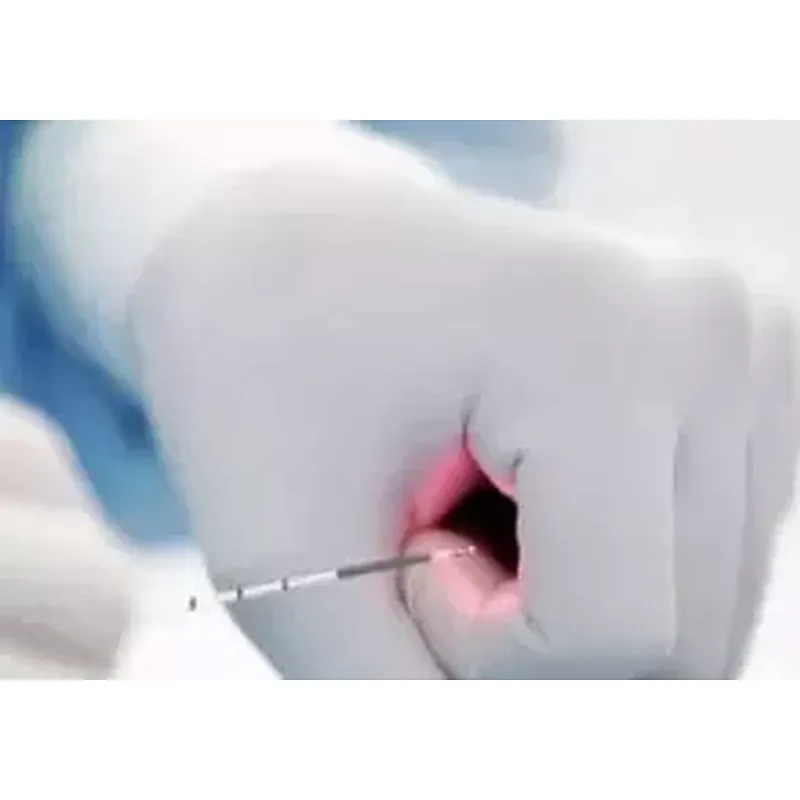 EVLT Treatment Dual 980nm 1470nm Endovenous Vein Laser Ablation/EVLT/EVLA Laser Device Use Radial Fiber