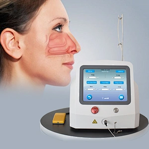 Non Invasive Ear Nose Throat Surgery  Laser ENT Surgical Diode Laser Treatment Medical Instruments