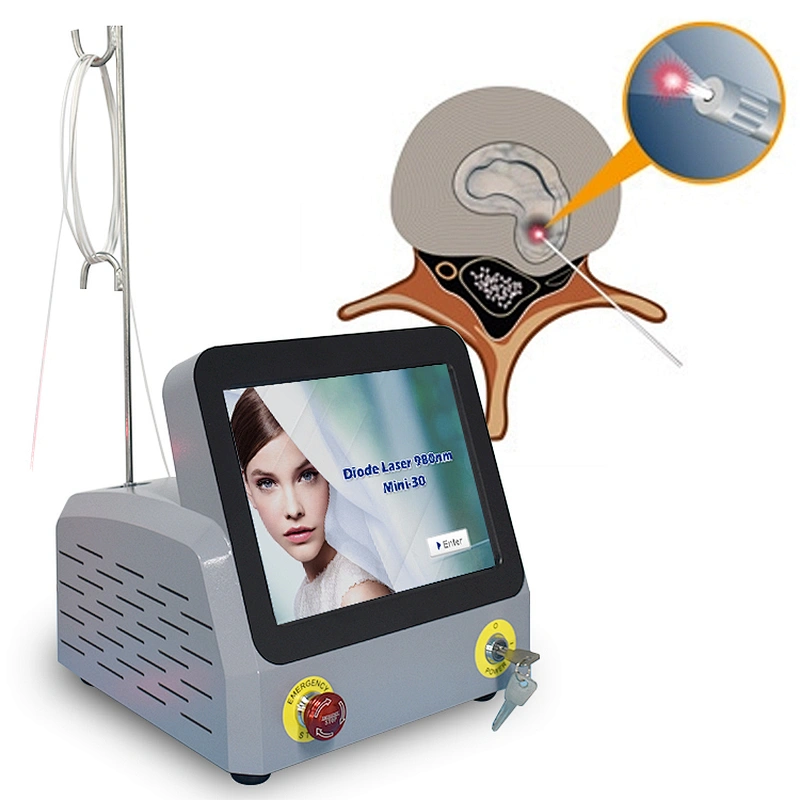 Class IV Medical Diode Laser 980nm PLDD Percutaneous Laser Treatment Machine