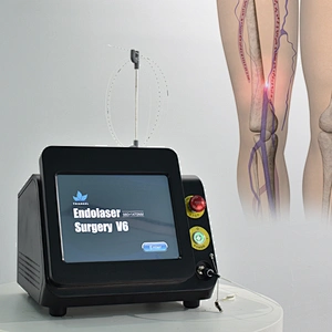 High quality radial fiber varicose veins 980nm diode laser 30w mini-invisive laser machine for evlt fibra radial