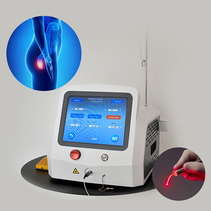 Directly Laser Factory 1470nm Hospital Clinical Surgery Diode Laser Proctology Hemorrhoids 980nm Laser