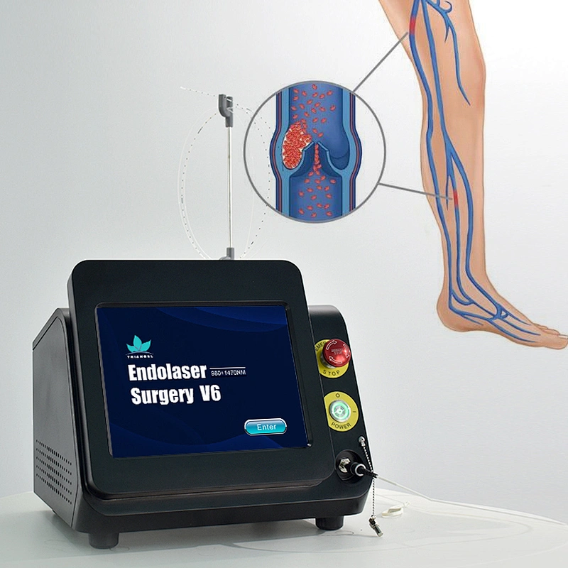 New Laser 1470nm Varicose Veins EVLT 1470 nm Diode Laser Therapy Machine