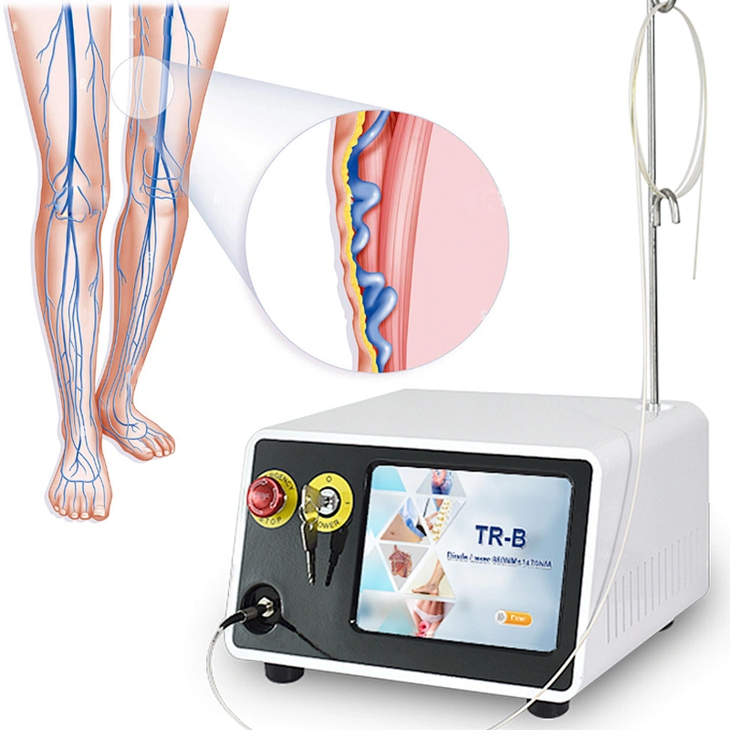 High Quality Portable 980nm 1470nm Diode Laser Varicose Veins Laser Treatment Machine