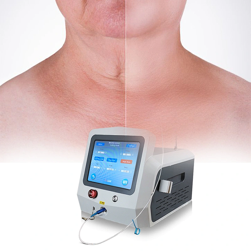 1470nm Laser Lipolysis Plastic Surgery / 1470nm Endolaser Liposculpture Laser