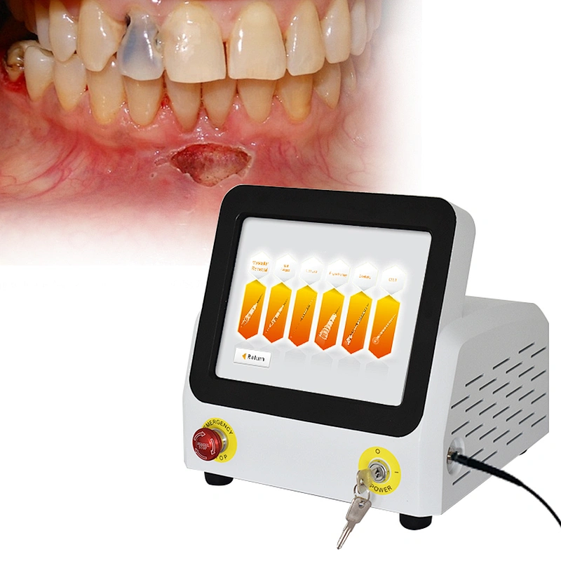 Hottest Portable Dentistry Laser Treatment Machine With Single Wave 980nm Wavelengths