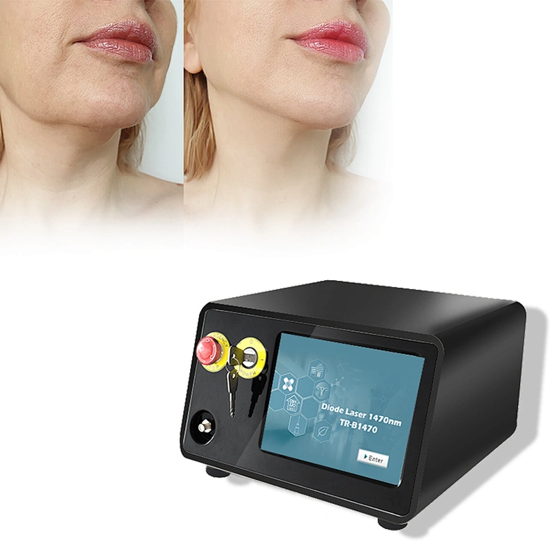 1470 Laser Lipolysis Face Lift Double Chin  Lipo Machine for Sale