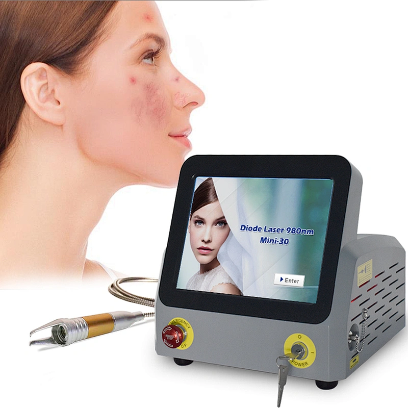 Newest 980nm Diode Laser Vascular Remove 980nm 30w Laser Machine for Spider Treatment Beauty Treatment