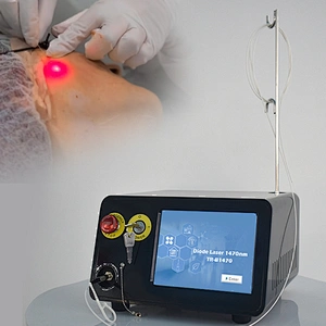Most Effective 1470nm Laser Liposuction Machine Endolaser Lifting Diode Laser