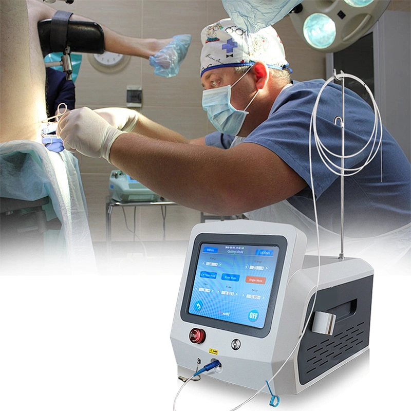 High Quality Hemorrhoids 980nm 1470nm Laser Machine 47w Mini-invasive Treatment for Hemorrhoids Fistula