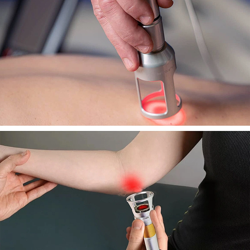 China Hot Sale Laser Physiotherapy Pain Relief 980nm Diode Laser Machine