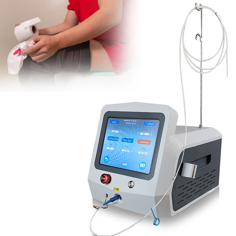 Diode Laser 1470nm Minimally Invasive Proctology Surgery Machine 980nm Removal Anal Fistula Hemorrhoids