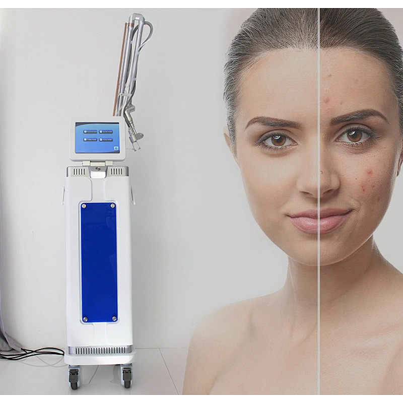 2024 Hot Sale 3 in 1 Skin Rejuvenation  Scar Revmoval Vaginal Laser Tightening  Face Lifting Equipment Tube Laser