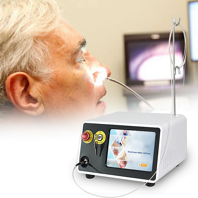 980nm or 1470 nm High Power Medical Diode Laser in ENT Treatment