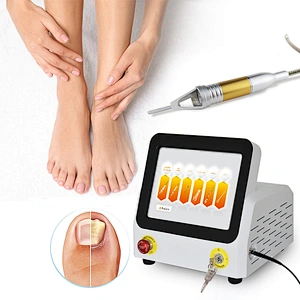 Foot Nail Fungus Laser Treatment Device Toe Nail Laser Fungus Treatment Professional Podiatry Podiatrist Use