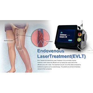 Dual Wave 980nm Class Iv Surgical Laser Equipment for Varices Des Membres Inferieurs Varicose Veins Evlt  Evla Varice