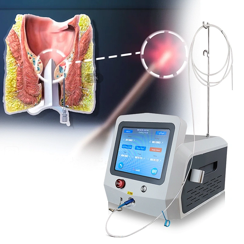 Medical CE Authentication Diode Laser Treat Hemorrhoids Surgery Machine 980nm1470nm Cutting Hemorrhoids/Anal Fistula