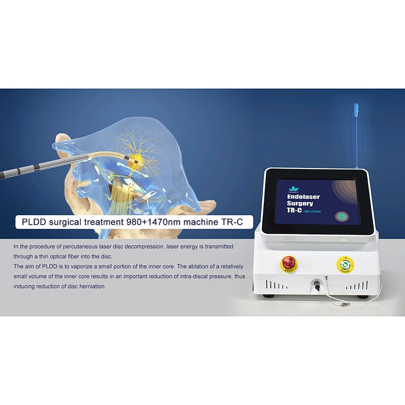 2024 the Hottest Machine PLDD Laser Treatment Diode Laser 980nm 1470nm for PLDD