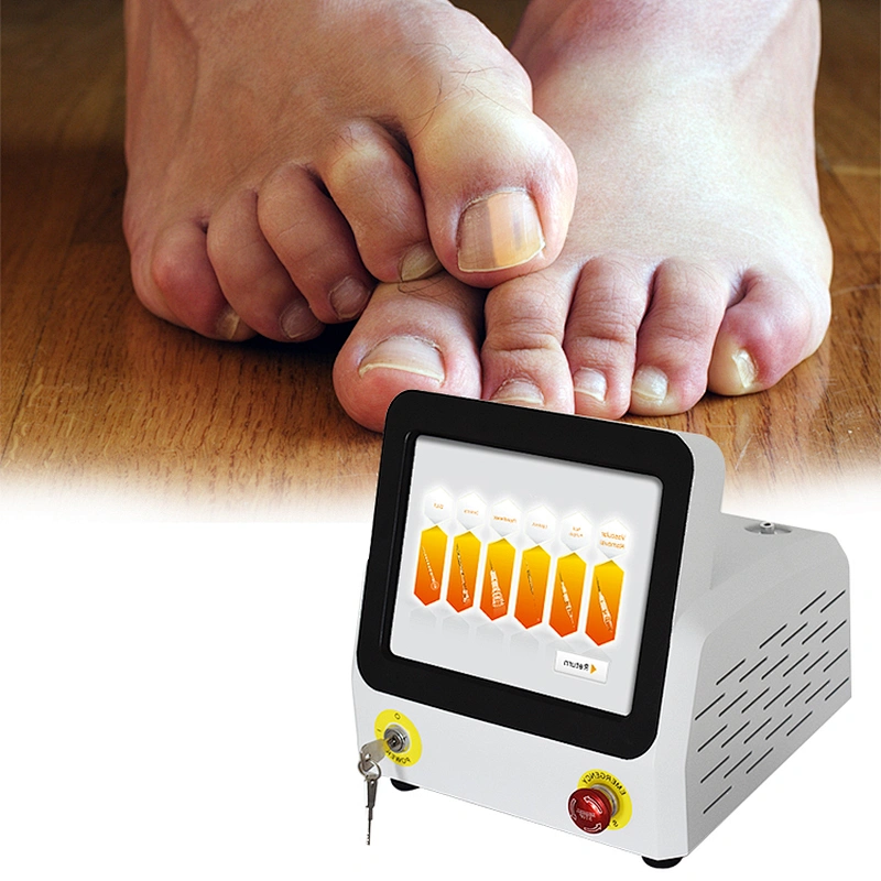 Class IV 980nm Fungus Nail Removal Laser Machine Diode Laser Treatment Podiatry Onychomycosis