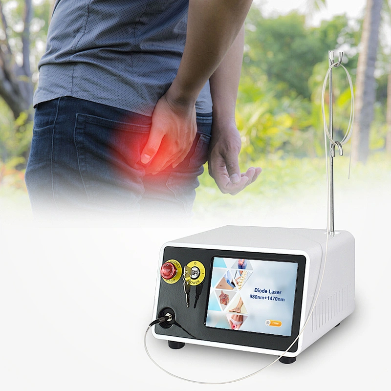 Hemorrhoidectomy Laser Surgery 1470nm 980nm Hemorrhoids Laser Treatment Proctology Laser