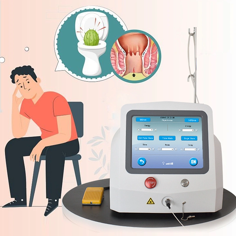 True 980nm 1470nm Diode Laser Machine Treatment Hemorrhoid Laser Ablation Proctology Surgical Laser Device Surgical Instrument
