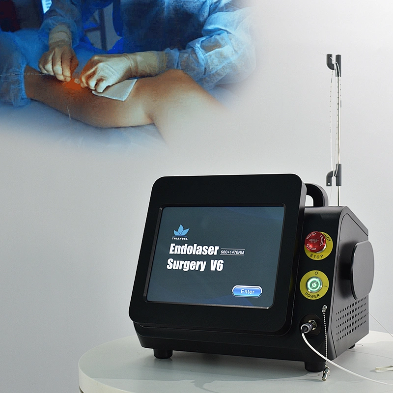 Diode Laser Removal Legs Varicose Veins 980nm 1470nm EVLT Endovenous Varicose Veins Treatment Machine