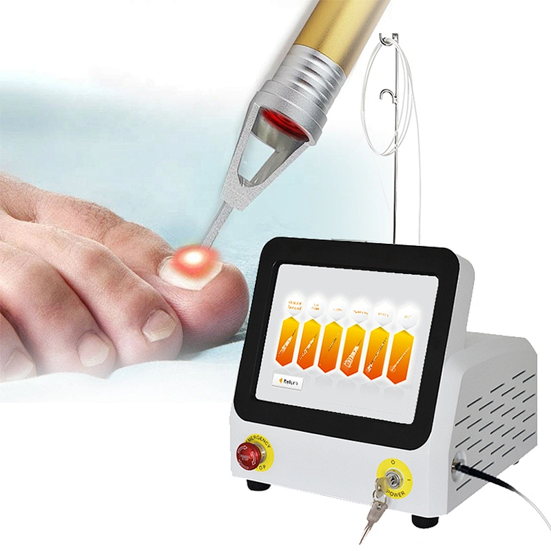 Professional Portable 980nm Class IV Diode Laser Therapy Equipment /nail Fungus/Onychomycosis