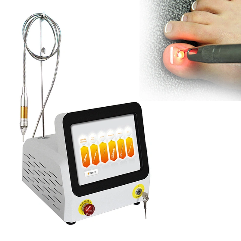 Foot Nail Fungus Laser Treatment Device Toe Nail Laser Fungus Treatment Professional Podiatry Podiatrist Use