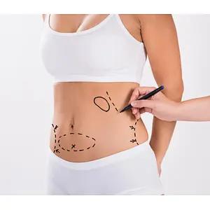 Triangel Laser Diode Laser Liposuction for Double Chin 980nm Endolaser Lipolysis Liposuction Machine