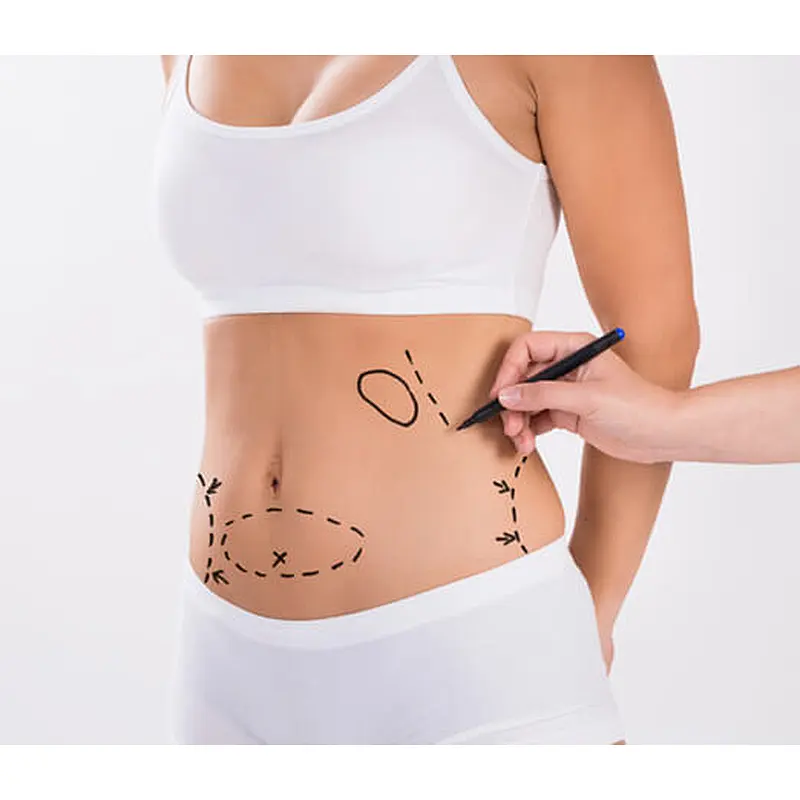 Triangel Laser Diode Laser Liposuction for Double Chin 980nm Endolaser Lipolysis Liposuction Machine
