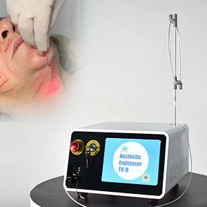 Newest Portable 980nm147nm Diode Laser Vaser Liposuction Skin Tightening Machine Removal Double Chin Endolaser Face Lifting