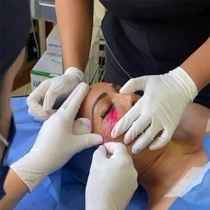 Professional Endolaser Liposuction 980nm 1470nm Diode Laser Lipolysis Surgery Machine Endolaser