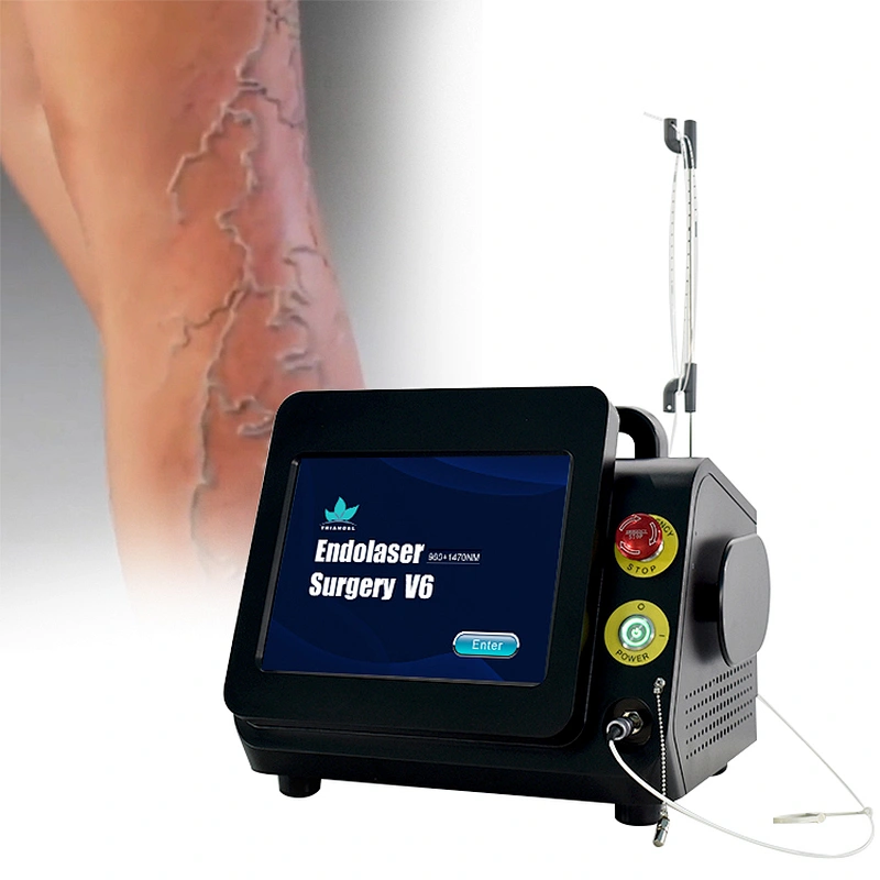 980nm1470nm Leg Varicose Vein  Laser EVLT EVLA  Endovenous Vein Surgery Laser Machine
