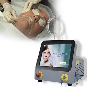 Triangel 980nm Laser Skin Tightening Eyebags  Lipolysis  Machine