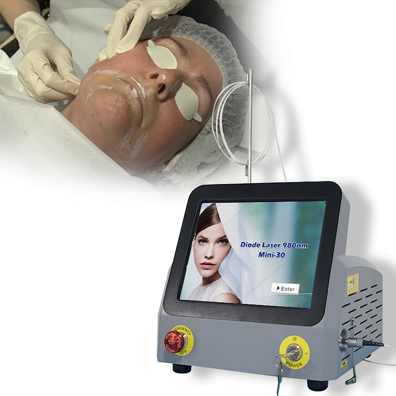 Triangel 980nm Laser Skin Tightening Eyebags  Lipolysis  Machine