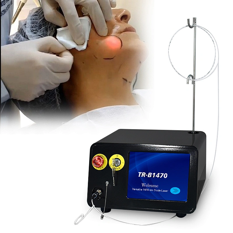 Hot Sale Medical Surgery Lipo Laser Device 980 1470nm Diode Laser Firming Face Endolaser Body Shaping Liposuction Machine