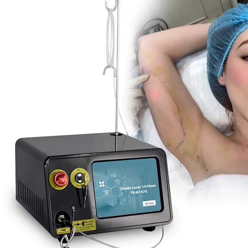 Endo Laser Diodo  Lipo Laser Machine 1470 Lipolysis Laser Fibra Endolaser Lipolise Lift