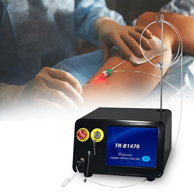 Professional Medical 1470nm 17W EVLT EVLA Diode Laser Treatment Varicose Veins Device Spider Veins Vascular Removal Machine