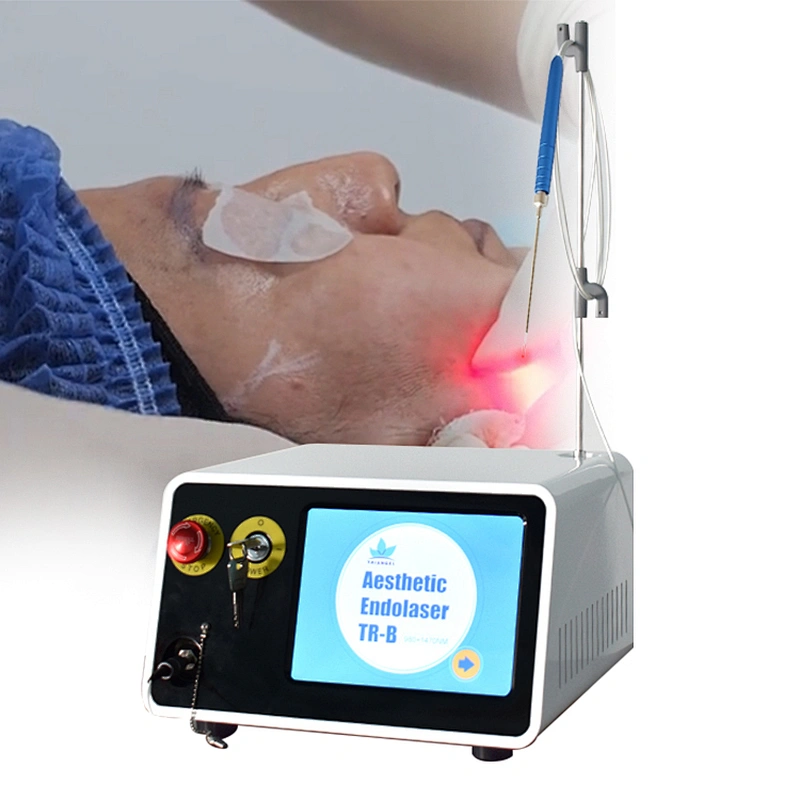 2025 Newest Professional Optical Fiber Lipolysis Surgery Endolaser Lift 980nm 1470nm Laser Machine