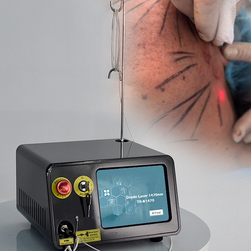 2025 Newest Liposuction Machine 980nm 1470nm Diode Laser Endolaser Facial Lifting