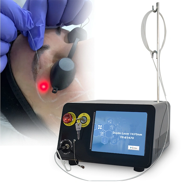Factory Supply Best Quality Liposuction Lipolysis Endolaser Fat Reduction Skin Rejuvenation Face Lifting Laser 1470nm